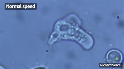  Naegleria - En Mikroskopisk Rövare Med Ett Ödesdigert Apipp