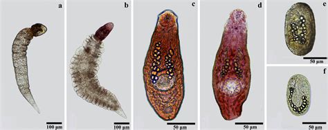   Trematoda Teichurus: En Parasit som Älskar Skaldjur! Och Nej, Du Vill Inte Träffa Den I Din Tallrik!